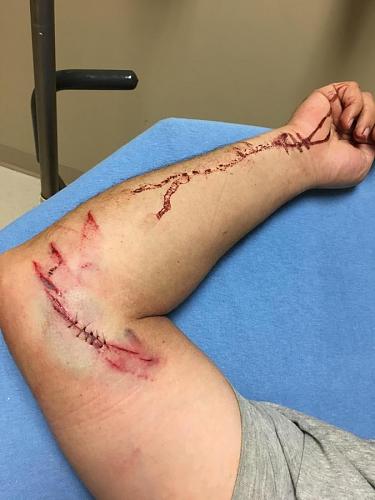 Click image for larger version

Name:	Arm3.jpg
Views:	432
Size:	60.5 KB
ID:	76702